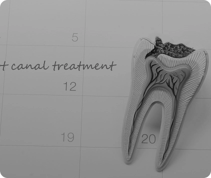 Root Canals 